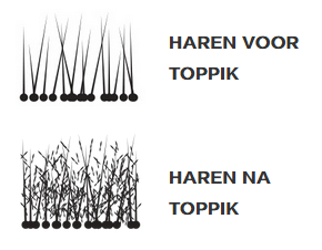 voor en na toppik